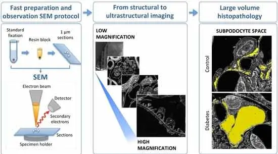 Scanning Electron Microscopy SEM analysis of materials